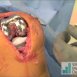 triathlon knee_FF_1.jpg